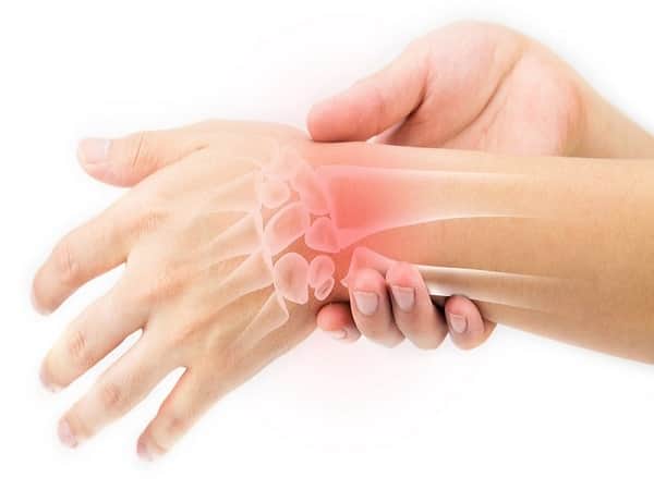 Hội chứng ống cổ tay là gì?