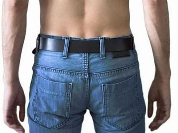 Mụn ruồi ở hậu môn có ý nghĩa gì?